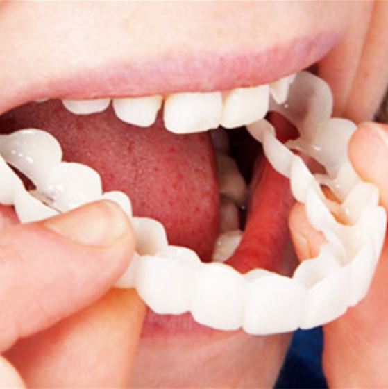 Veneers | Flexible Fit without Adhesive | For Eating, Drinking, and Everyday Use | SnapSmile