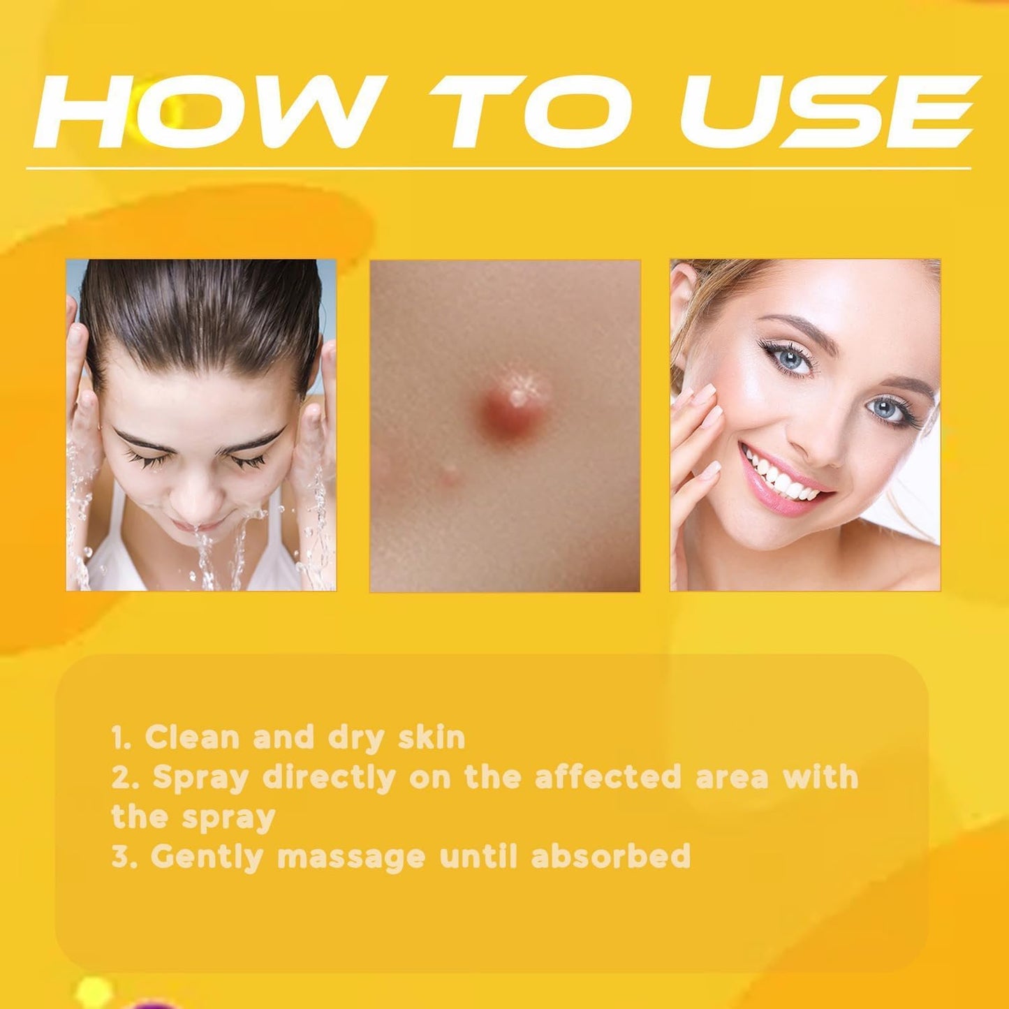 Wart Remover | Targeted Skin Spray | Bee Venom Care Formula | TagAway