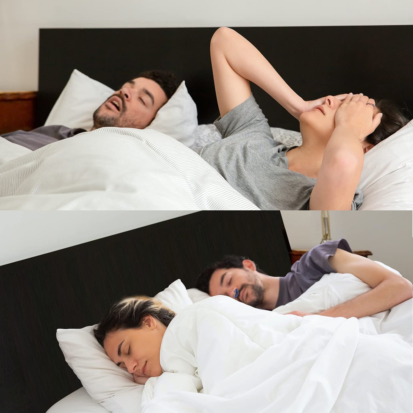 Anti-Snoring Device | Cordless, Maskless Micro-CPAP
