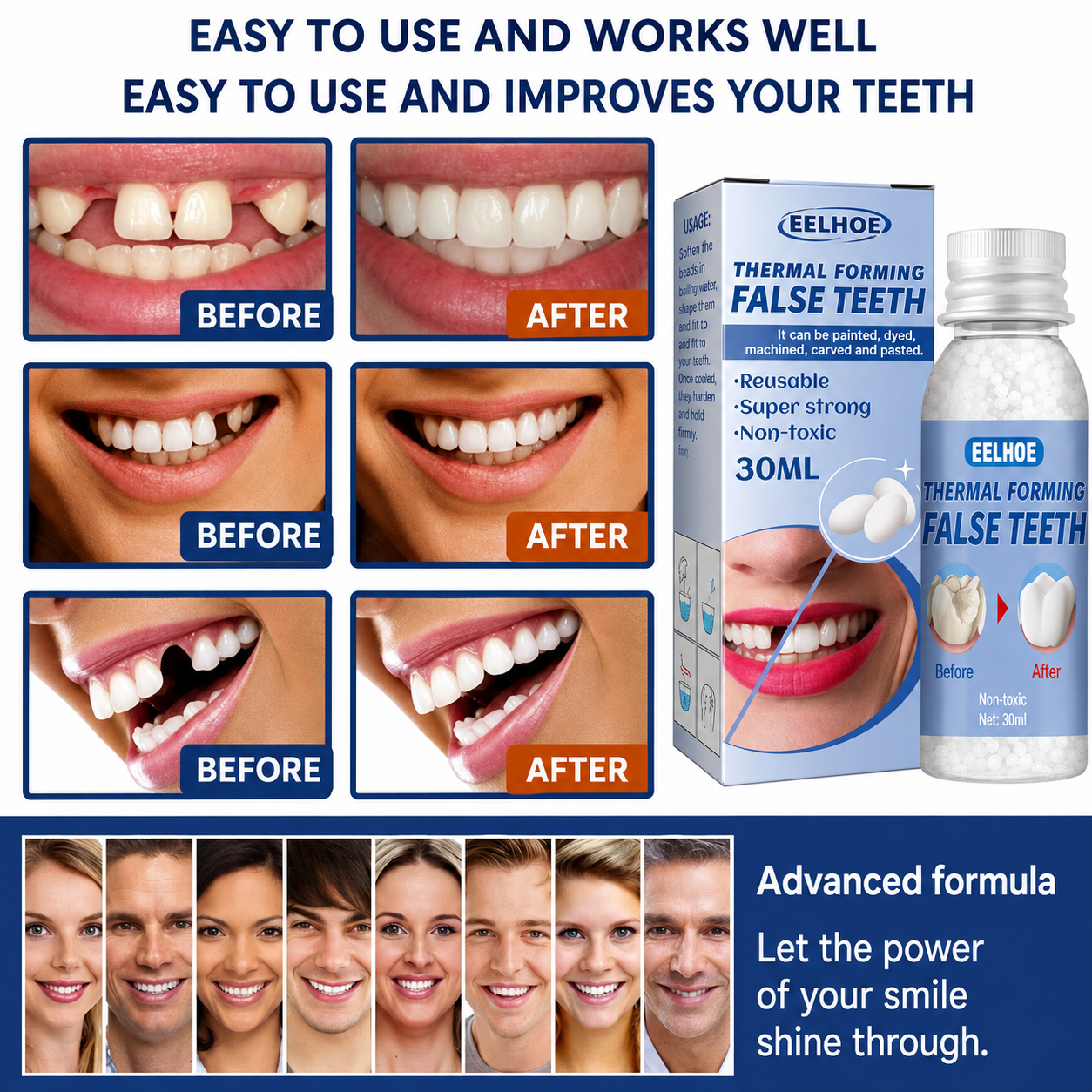 Dental Care | Tooth Repair Kit | Instant Filling of Tooth Gaps | ToothPerfect