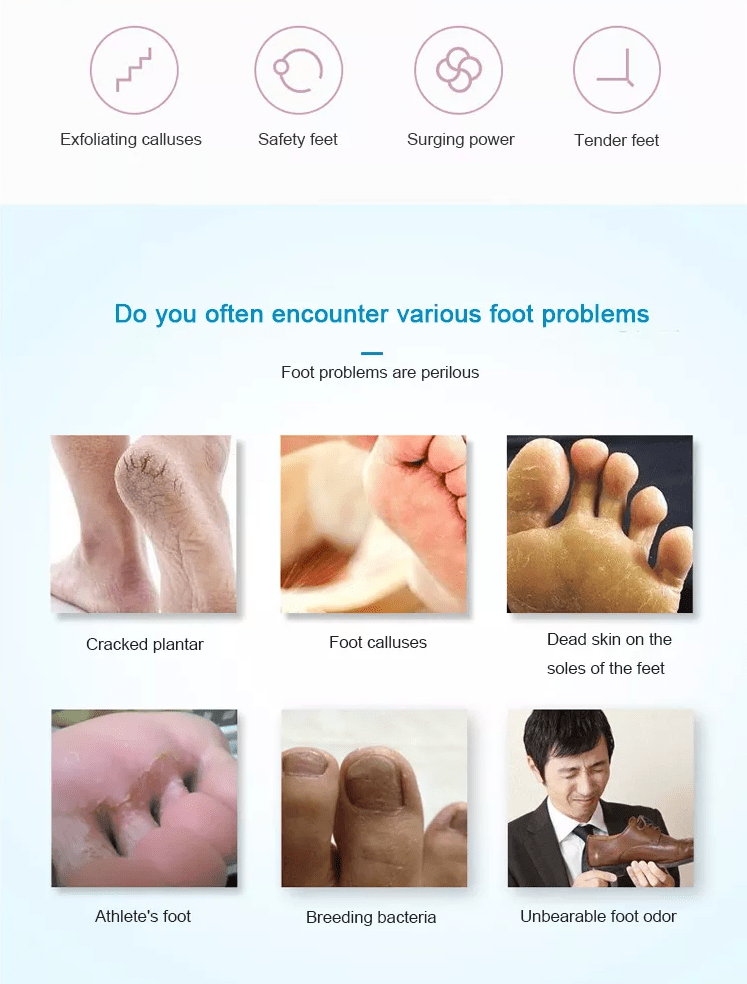 Electric Pedicure Foot File - Rechargeable via USB