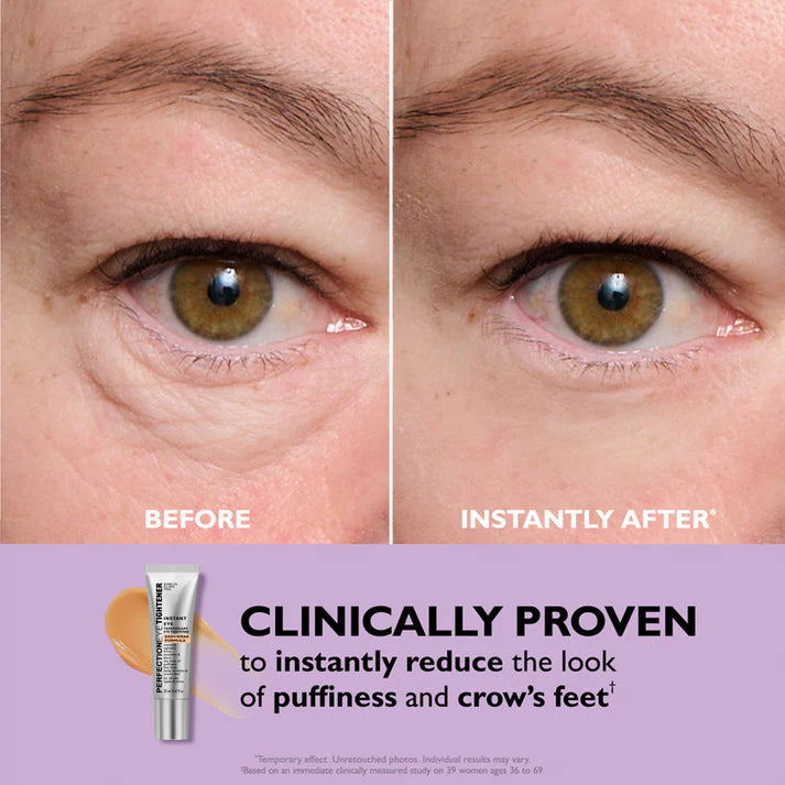 Eye Cream | Against Dark Circles & Wrinkles | Instant Fresh Look