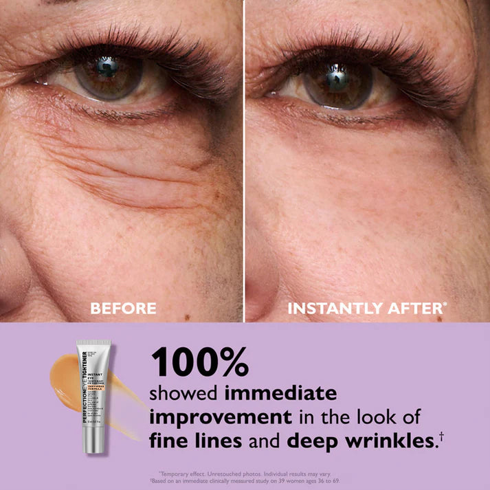 Eye Cream | Against Dark Circles & Wrinkles | Instant Fresh Look