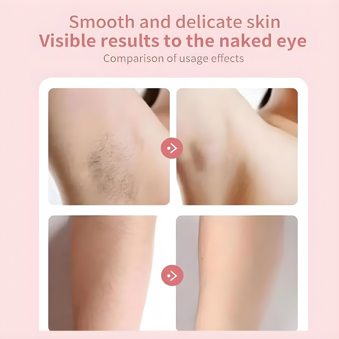 HairRemover: Rechargeable Epilator Pain-Free Electric Hair Removal Device