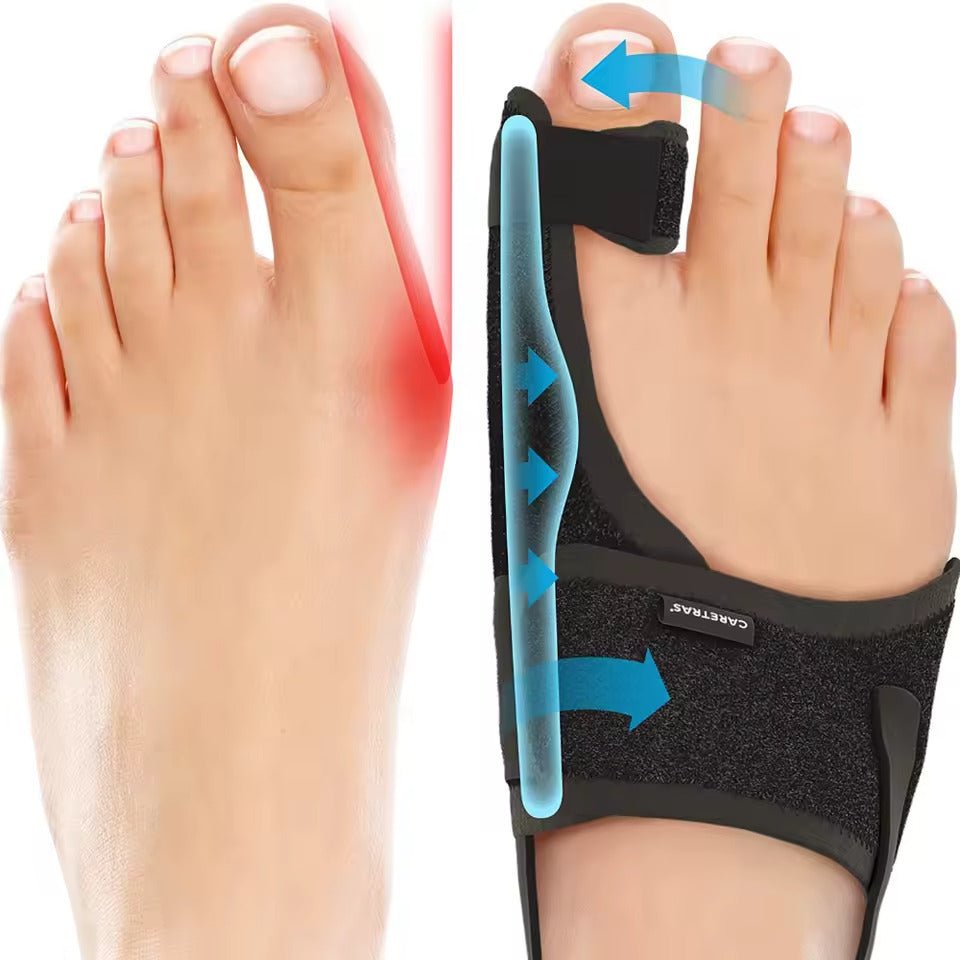 Night Splint for Hallux Valgus - Ergonomic and Adjustable Comfort
