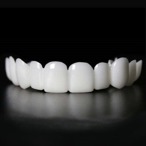 Snap-On Tooth Veneers – Direct Smile Correction for Imperfections
