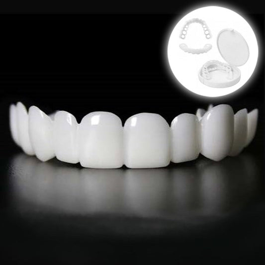 Snap-On Tooth Veneers – Direct Smile Correction for Imperfections