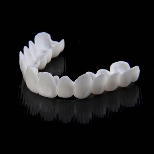 Snap-On Tooth Veneers – Direct Smile Correction for Imperfections
