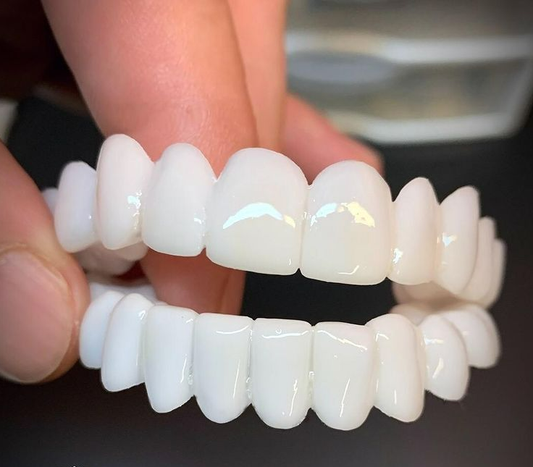 SusanSmith | DentAlign Dental Veneers – Natural Fit and Comfort