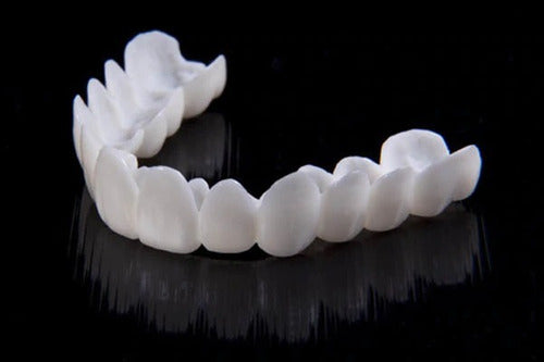 SusanSmith | DentAlign Dental Veneers – Natural Fit and Comfort