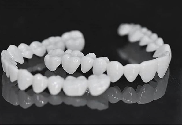 SusanSmith | DentAlign Dental Veneers – Natural Fit and Comfort