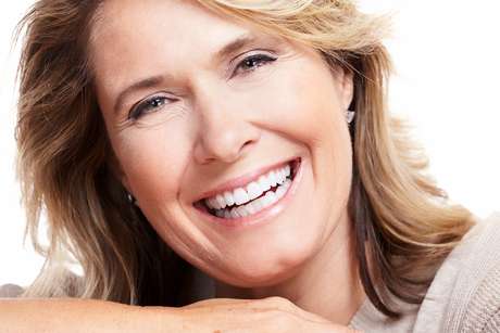 SusanSmith | DentAlign Dental Veneers – Natural Fit and Comfort