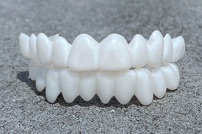 SusanSmith | DentAlign Dental Veneers – Natural Fit and Comfort