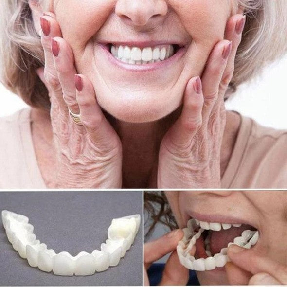 SusanSmith | On Smile Veneers (Upper and Lower Jaw included)