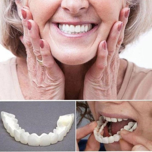 SusanSmith | On Smile Veneers (Upper and Lower Jaw included)