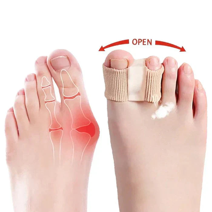 ToeSeparators: Premium Toe Separators for Comfortable Toe Alignment