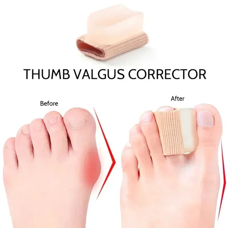 ToeSeparators: Premium Toe Separators for Comfortable Toe Alignment