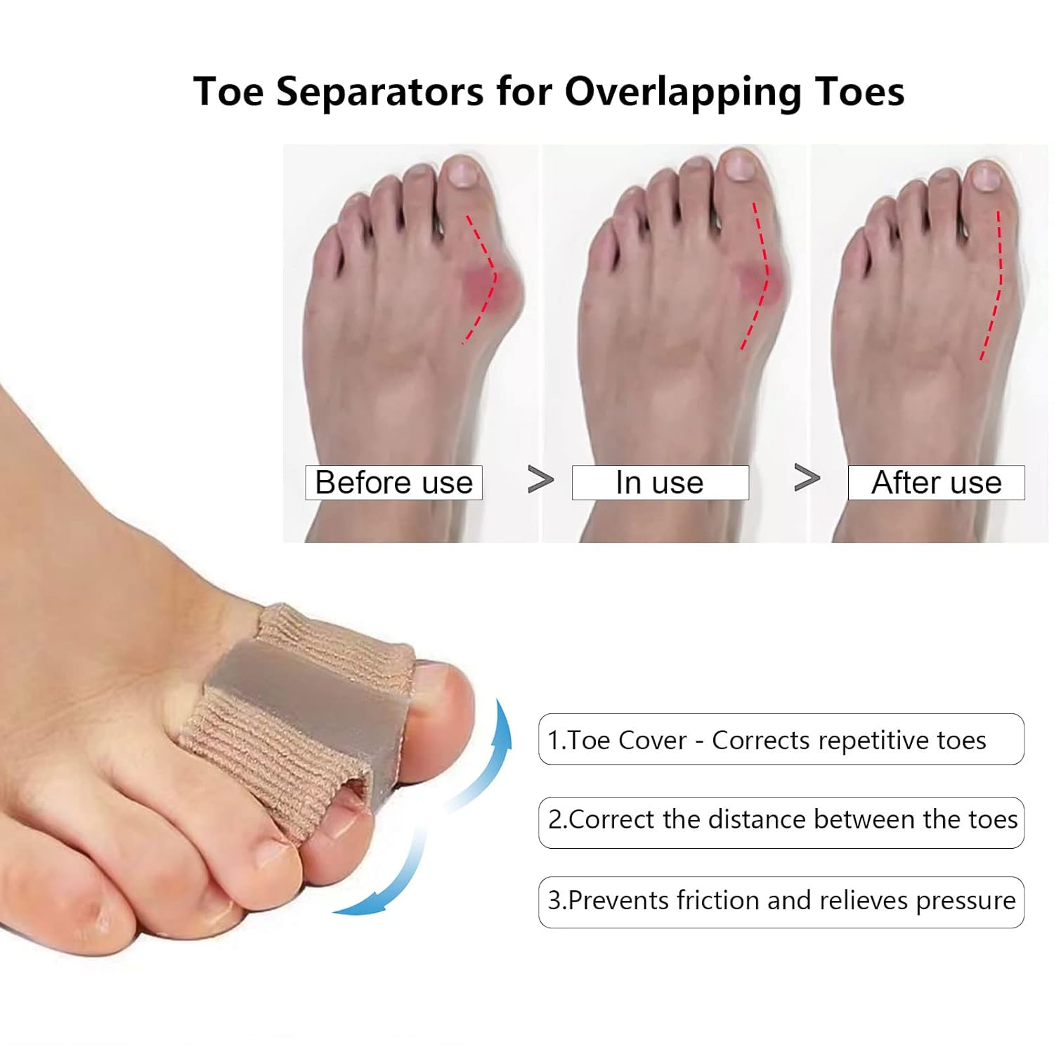 ToeSeparators: Premium Toe Separators for Comfortable Toe Alignment