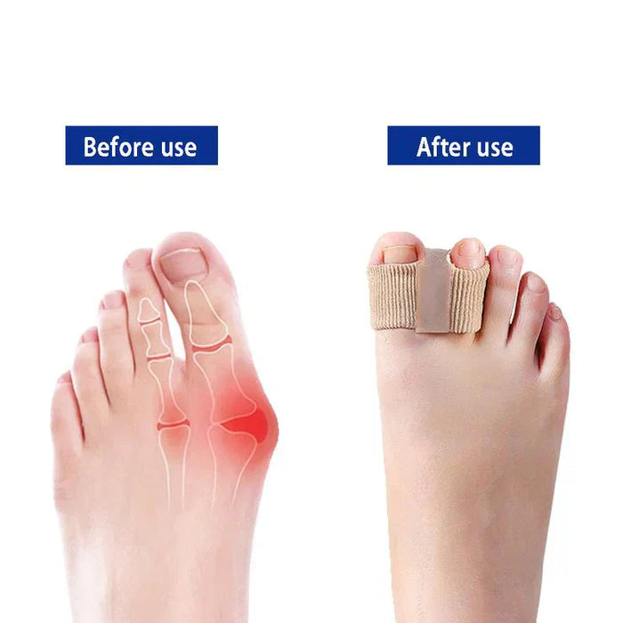 ToeSeparators: Premium Toe Separators for Comfortable Toe Alignment