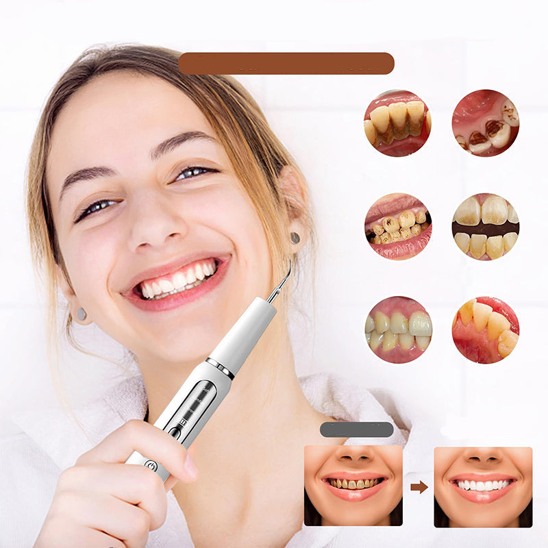 Ultrasonic Dental Plaque Remover – Rechargeable Teeth Cleaner