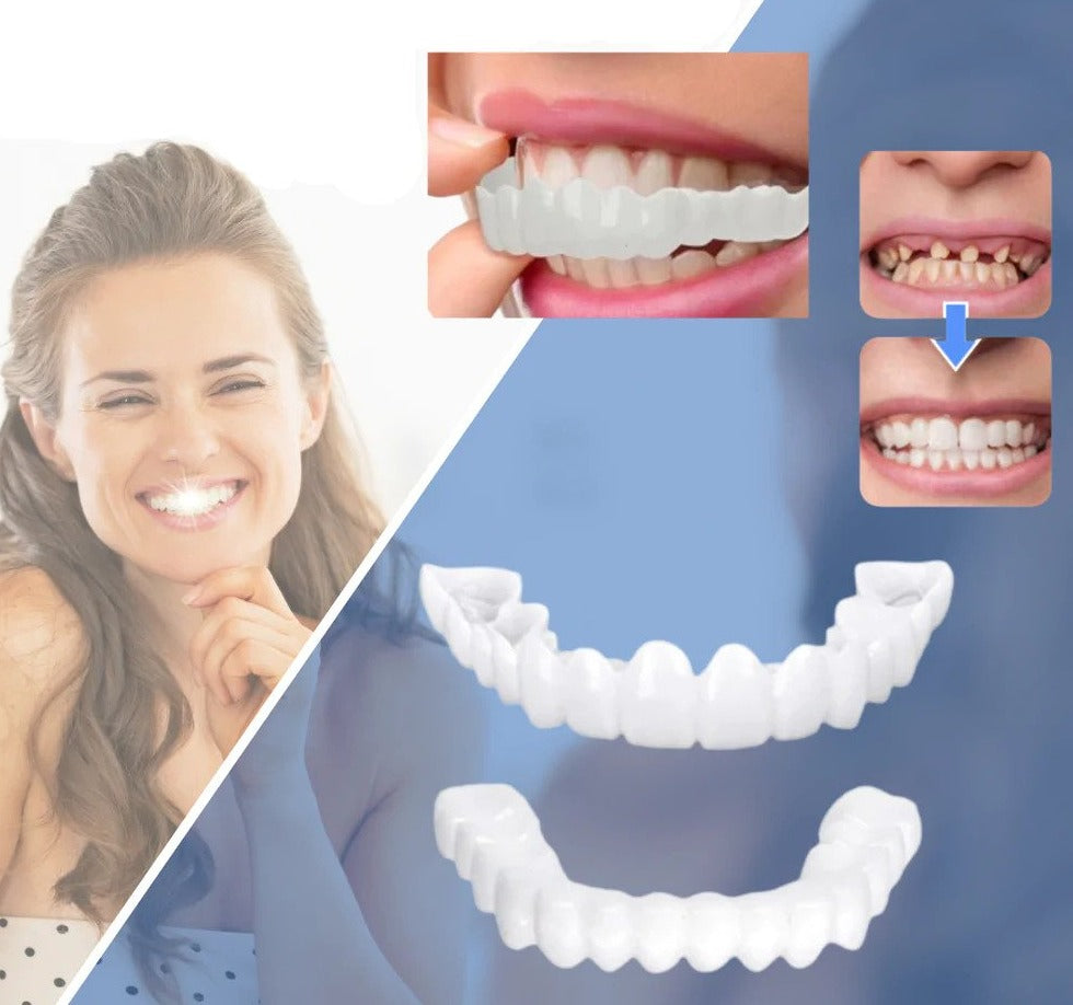 Veneers | Flexible Fit without Adhesive | For Eating, Drinking, and Everyday Use | SnapSmile