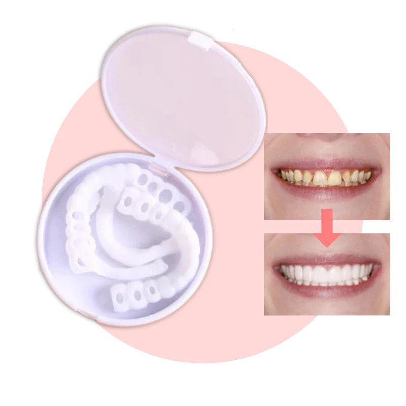 Veneers | Flexible Fit without Adhesive | For Eating, Drinking, and Everyday Use | SnapSmile