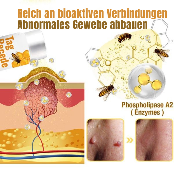 Wart Remover | Wart Spray | Bee Venom Formula | Pain-Free | SkinPurex